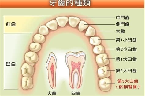 智慧齒橫生|【智慧齒痛多久】智慧齒橫生怎麼辦、需要開刀嗎？或。